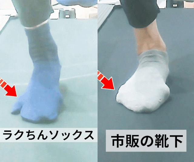 内反小趾になる原因