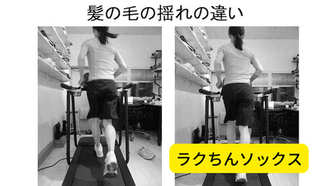 疲労骨折の原因はランニングの衝撃