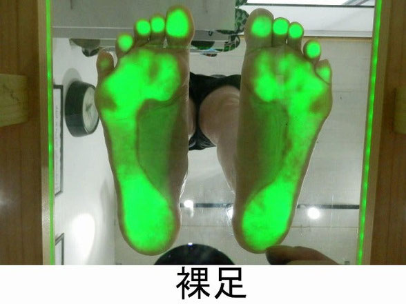 足底筋膜炎の改善方法