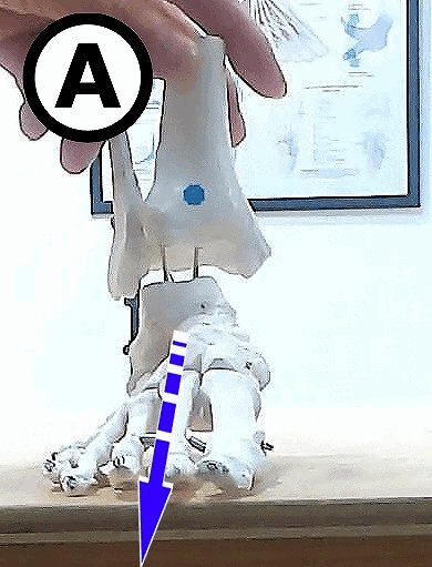 アーチが倒れ込むことによって発生するトゥーアウトを解説した図