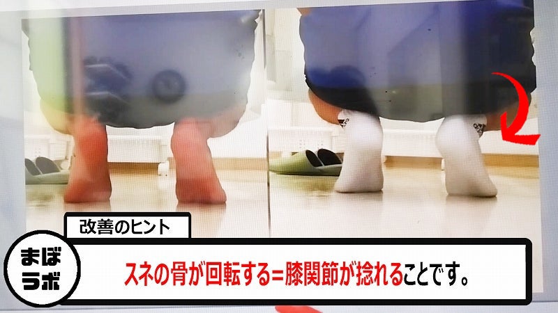 膝のねじれと変形性関節症の関係