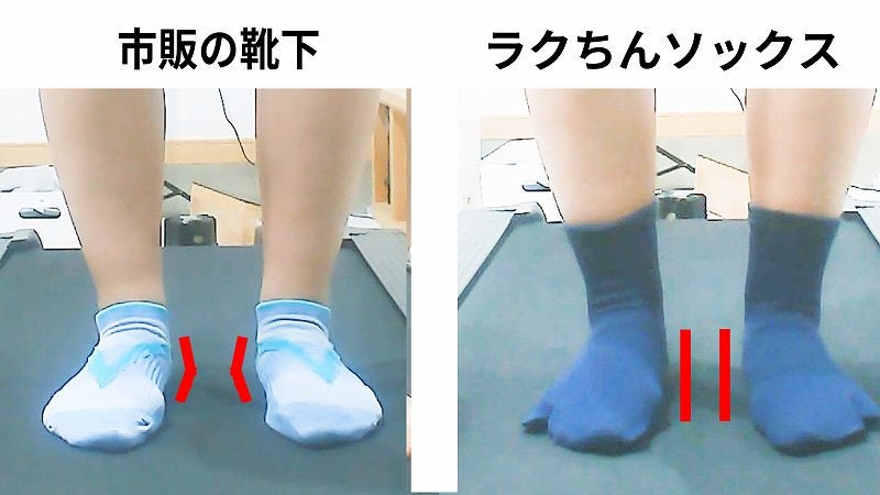 靴下で変わる足のアーチ比較