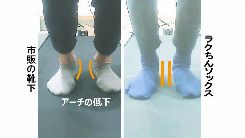 靴下による足のアーチ低下比較