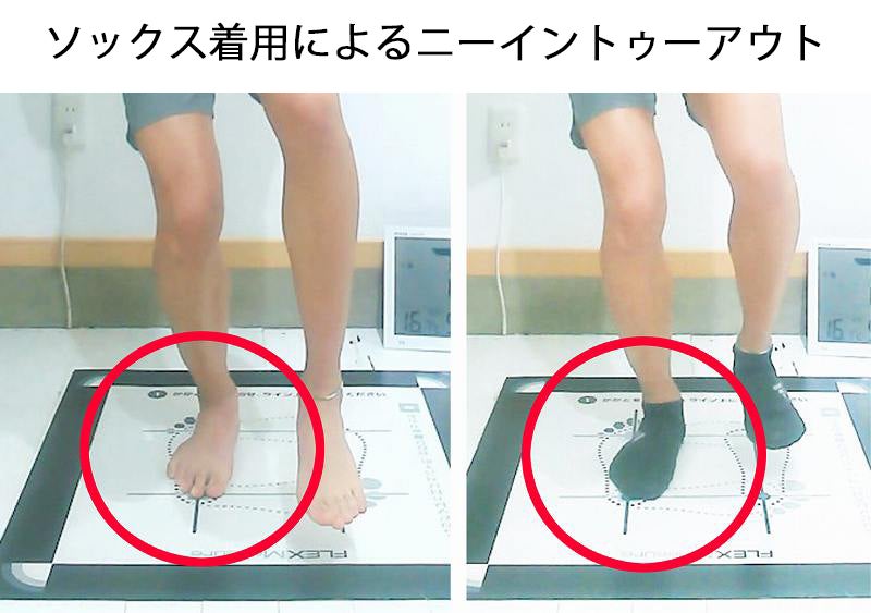 靴下着用によるニーイン・トゥアウトの変化