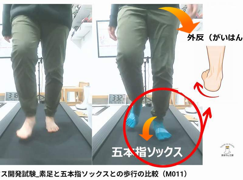 靴下で変わる足の傾きとアーチ