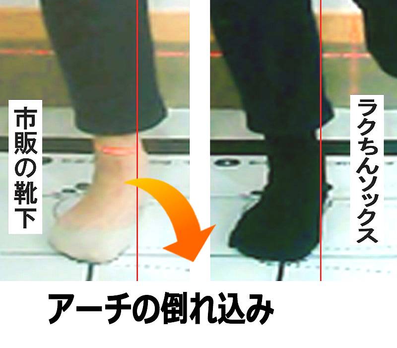 靴下で変わる足のアーチ低下