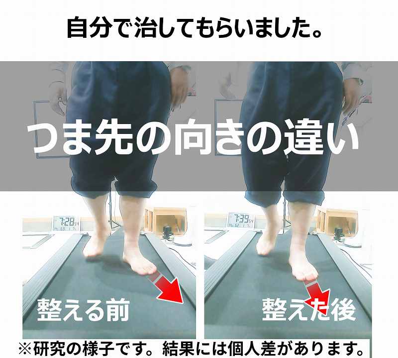 つま先の向きの変化：整える前と整えた後
