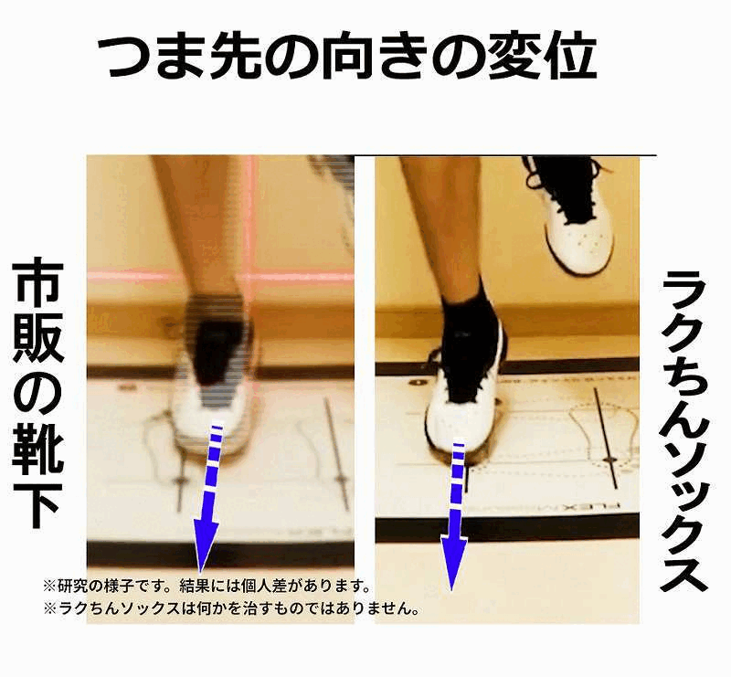 つま先の向きと靴下の比較、トゥアウト解説