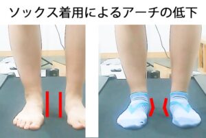 靴下着用によるアーチ低下の比較