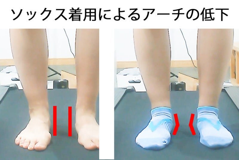 靴下着用によるアーチ低下の比較