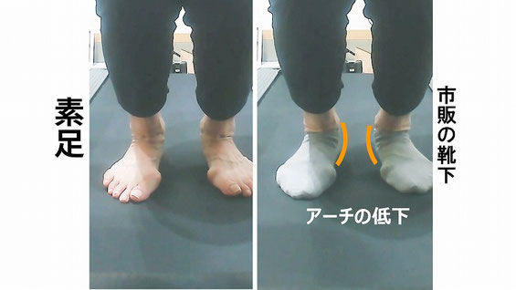 靴下を履くと足のアーチが低下している様子