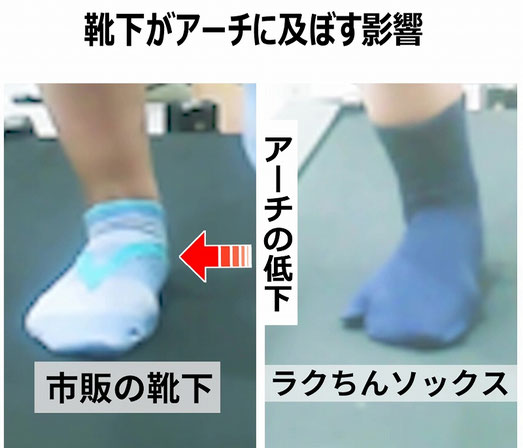 ソックスの違いによるアーチの低下