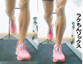 足のアーチ崩壊のメカニズム