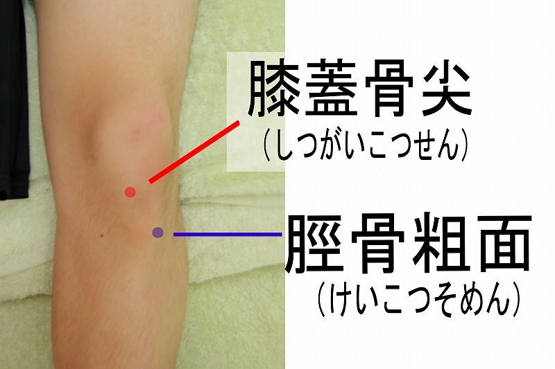 膝蓋骨尖と脛骨粗面の位置関係