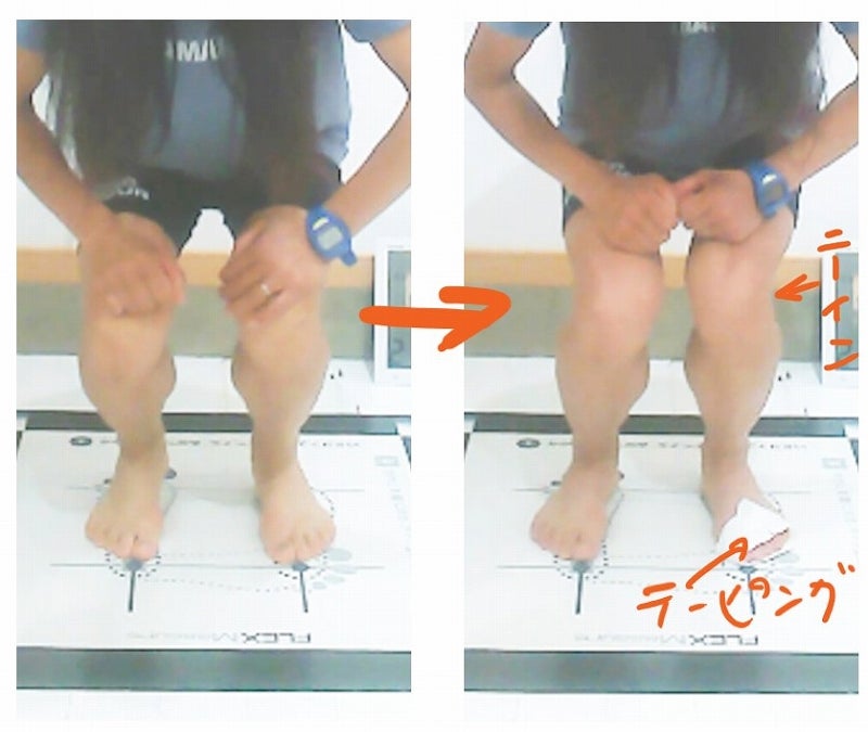 ニーイン・トゥーアウトとテーピング