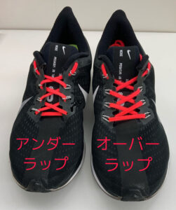 アンダーラップはベロの浮きあがりを許す (1)