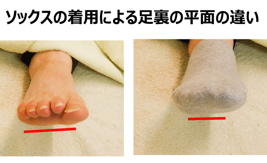 素足と靴下着用での、足の裏（水平アーチ）の形をあらわあしています。足の裏の形が変われば歩き方も変わります。タコ、うおのめ、マメができる原因です。