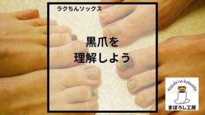 靴のせいじゃない?ランニングで黒爪を招く「NG靴下」の特徴 ランニングで黒爪を招く靴下の特徴を解説するまぼろし工房の記事画像