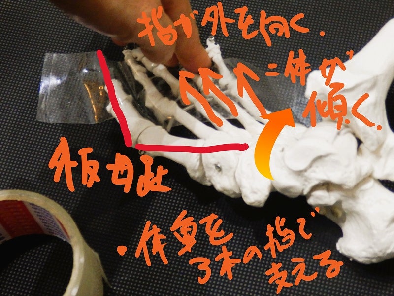 ヒールリフト時に足指が静止時よりさらに前方へ伸長する様子を示した比較画像