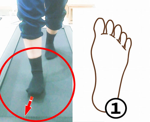 つま先が外を向いた歩き出しの様子