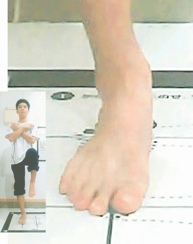 健全な足のヒールリフトでは、踵がまっすぐ上がり、足指が前へ伸びず床を捉えている