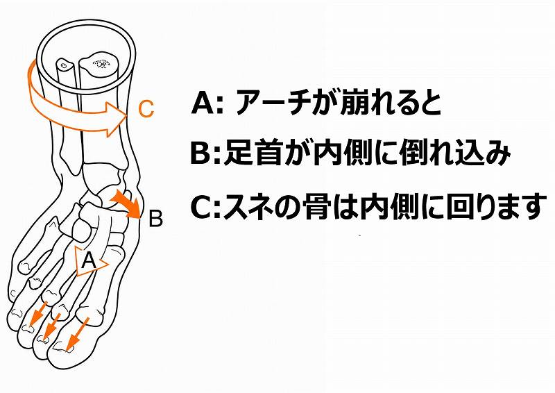 足部アーチが低下すると足首が内側へ倒れ込み、すねの骨が内旋する流れを示した図