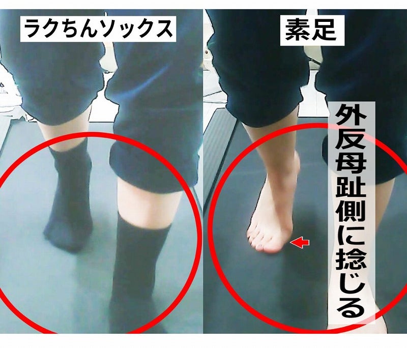 "素足とラクちんソックス着用時における足指の向きと使われ方の比較"