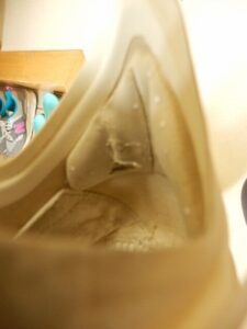踵の痛み│アキレス腱付着部滑液嚢炎 image