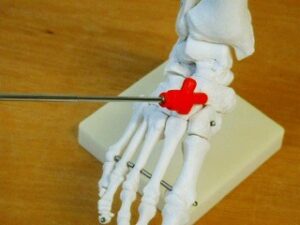 舟状骨│足のアーチの連動メカニズム image