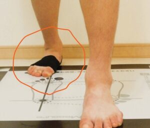つま先を外へ向けて行うアキレス腱ストレッチ。膝と足先の方向がずれ、足首と足裏にねじれが加わりやすい姿勢